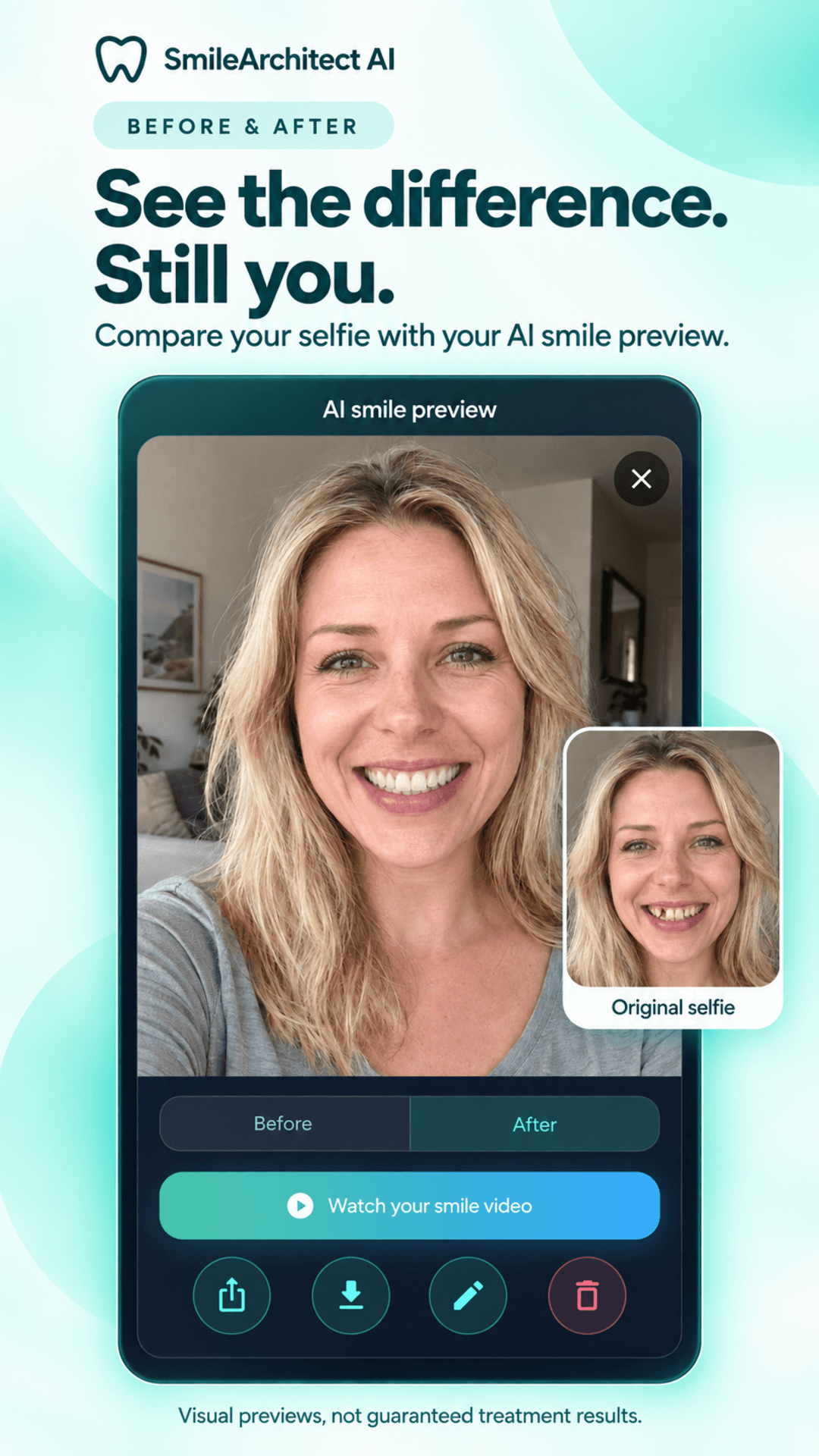 Smile Architect AI — previzualizare înainte și după
