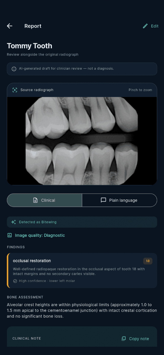 Selectare limbă de redactare raport clinic
